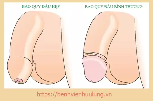 Bao quy đầu là gì? Như nào bình thường và không bình thường