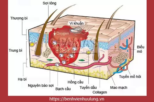 Bệnh hôi nách là gì