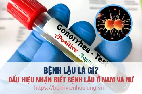 Bệnh lậu là gì