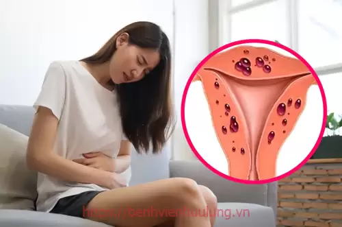 Đau bụng dữ dội là biến chứng điển hình của bệnh ung thư cổ tử cung