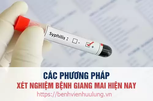 Các phương pháp xét nghiệm bệnh giang mai chính xác hiện nay