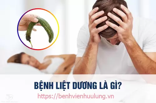 Bác sĩ tư vấn giải đáp bệnh liệt dương