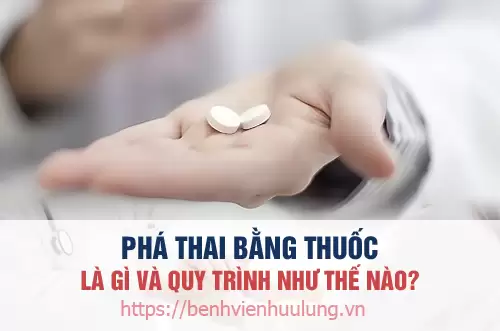 Phá thai bằng thuốc là gì?