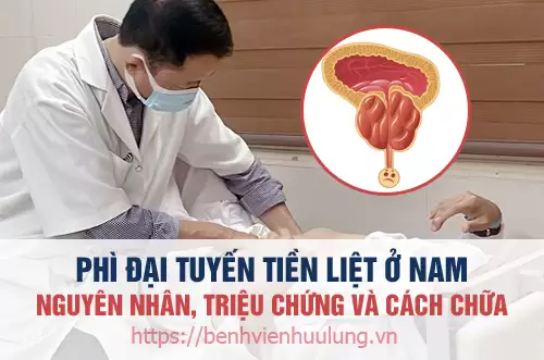 Bệnh phì đại tuyến tiền liệt ở nam giới