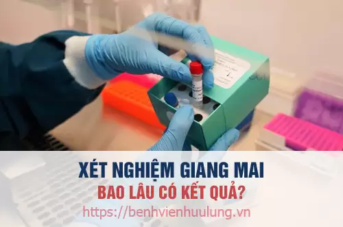Xét nghiệm giang mai bao lâu có kết quả