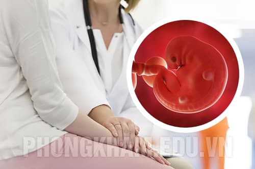 Các các phá thai an toàn dân gian tại nhà